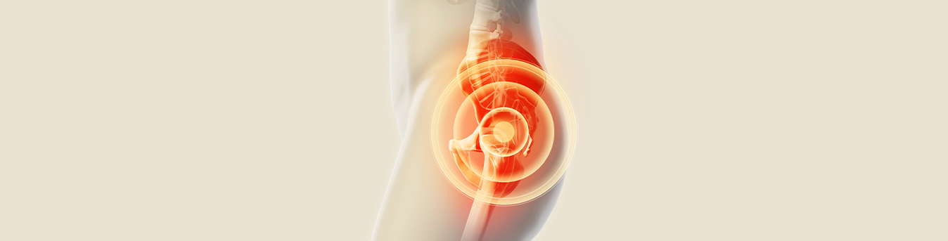 Getting hip replacement surgery? Here is everything you need to know